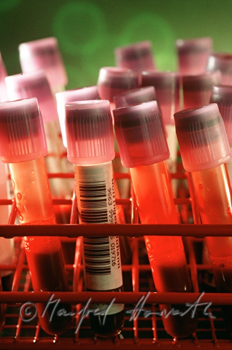 Blut in Proberöhrchen