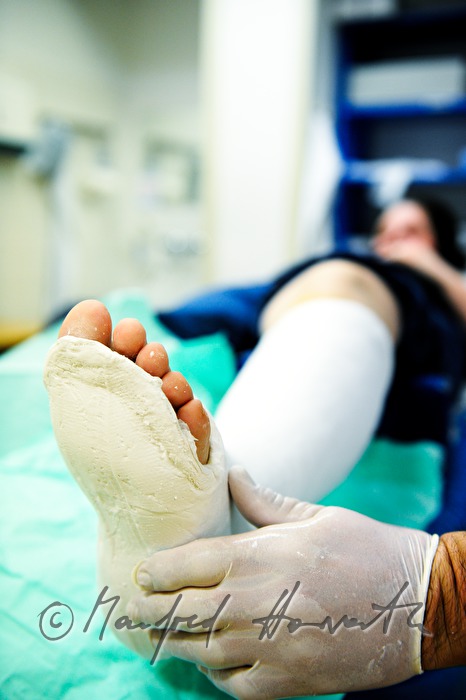 Patientin mit Beinbruch im Gipszimmer