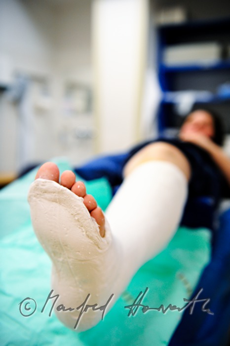 Patientin mit Beinbruch im Gipszimmer
