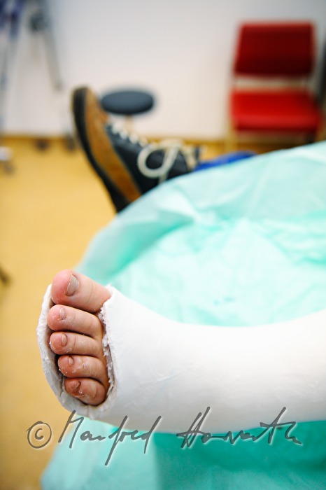Patientin mit Beinbruch im Gipszimmer