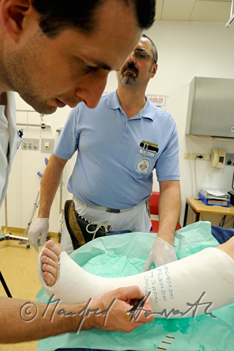 Arzt schreibt Datum auf das Gipsbein