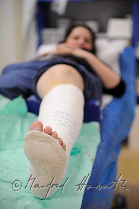 Patientin mit Beinbruch im Gipszimmer